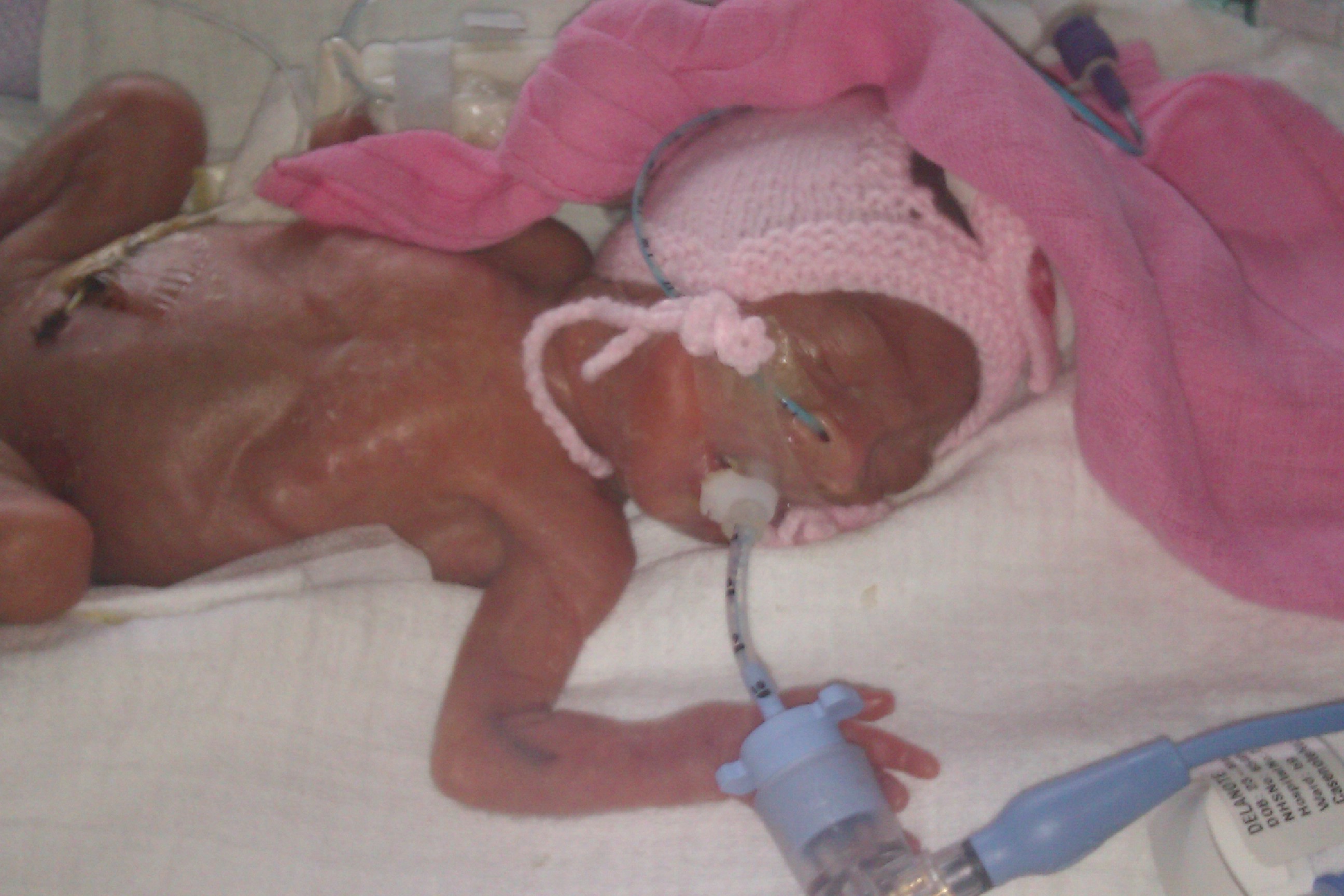 The-Healing-Of-The-1lb-Baby-6